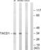 Epithelial Cell Adhesion Molecule antibody, abx013400, Abbexa, Western Blot image 