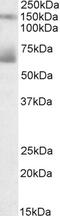 Tripartite Motif Containing 71 antibody, 42-541, ProSci, Western Blot image 