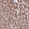Zinc Finger Protein 596 antibody, NBP2-49183, Novus Biologicals, Immunohistochemistry paraffin image 