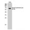 Keratin 2 antibody, LS-C380592, Lifespan Biosciences, Western Blot image 