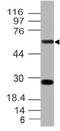 Ectonucleoside Triphosphate Diphosphohydrolase 1 antibody, M03196, Boster Biological Technology, Western Blot image 