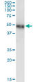 Nuclear Receptor Subfamily 2 Group F Member 1 antibody, LS-C198330, Lifespan Biosciences, Western Blot image 