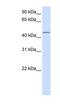 Parvin Beta antibody, NBP1-59129, Novus Biologicals, Western Blot image 