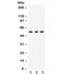 Integrin Linked Kinase antibody, R32407, NSJ Bioreagents, Western Blot image 