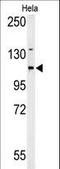 Adenylate Cyclase 4 antibody, LS-C156067, Lifespan Biosciences, Western Blot image 