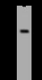 VPS26, Retromer Complex Component B antibody, 206144-T36, Sino Biological, Western Blot image 