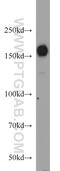 Histone Deacetylase 6 antibody, 12834-1-AP, Proteintech Group, Western Blot image 