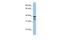 FKBP Prolyl Isomerase 8 antibody, PA5-42942, Invitrogen Antibodies, Western Blot image 