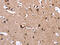 Alpha-1-antitrypsin antibody, CSB-PA799490, Cusabio, Immunohistochemistry paraffin image 