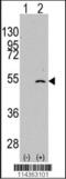 Elongator complex protein 3 antibody, 55-654, ProSci, Western Blot image 