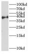 Homeobox D13 antibody, FNab03987, FineTest, Western Blot image 