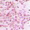 Mediator Complex Subunit 12 antibody, GTX56106, GeneTex, Immunohistochemistry paraffin image 