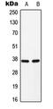 CEBPA antibody, MBS820794, MyBioSource, Western Blot image 