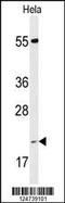 Peptidylprolyl Isomerase C antibody, MBS9204543, MyBioSource, Western Blot image 