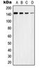 Ubiquitin Specific Peptidase 42 antibody, orb215319, Biorbyt, Western Blot image 