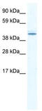 DEAD-Box Helicase 49 antibody, TA341609, Origene, Western Blot image 