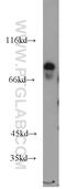 Potassium Voltage-Gated Channel Subfamily J Member 1 antibody, 20953-1-AP, Proteintech Group, Western Blot image 