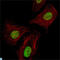 Ring Finger And CHY Zinc Finger Domain Containing 1 antibody, LS-C812741, Lifespan Biosciences, Immunohistochemistry paraffin image 