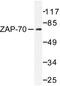 Zeta Chain Of T Cell Receptor Associated Protein Kinase 70 antibody, LS-C176484, Lifespan Biosciences, Western Blot image 