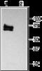 Potassium Voltage-Gated Channel Subfamily A Member 3 antibody, GTX16637, GeneTex, Western Blot image 