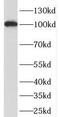 2 -5 -oligoadenylate synthase 3 antibody, FNab05952, FineTest, Western Blot image 