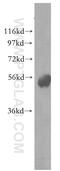 Death Associated Protein Kinase 3 antibody, 51021-1-AP, Proteintech Group, Western Blot image 