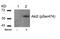 RAC-beta serine/threonine-protein kinase antibody, PA5-37470, Invitrogen Antibodies, Western Blot image 