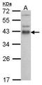 Cyclic AMP-dependent transcription factor ATF-1 antibody, GTX100062, GeneTex, Western Blot image 