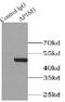 Adaptor Related Protein Complex 1 Subunit Mu 1 antibody, FNab00459, FineTest, Immunoprecipitation image 