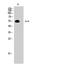 Erythropoietin Receptor antibody, STJ96381, St John