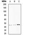 ST6 Beta-Galactoside Alpha-2,6-Sialyltransferase 1 antibody, LS-C352845, Lifespan Biosciences, Western Blot image 