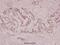 Cytochrome P450 Family 21 Subfamily A Member 2 antibody, A00821, Boster Biological Technology, Immunohistochemistry frozen image 