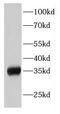 Eukaryotic Translation Initiation Factor 2 Subunit Alpha antibody, FNab02699, FineTest, Western Blot image 