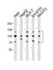 Fibroblast Growth Factor Receptor 1 antibody, A00098-2, Boster Biological Technology, Western Blot image 