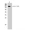 Epidermal Growth Factor Receptor Pathway Substrate 15 antibody, LS-C381062, Lifespan Biosciences, Western Blot image 