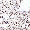 Regulator Of Chromosome Condensation 1 antibody, GTX64560, GeneTex, Immunohistochemistry paraffin image 