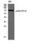 IL2 Inducible T Cell Kinase antibody, A01385Y512, Boster Biological Technology, Western Blot image 