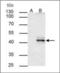 Heat Shock Protein 90 Alpha Family Class B Member 1 antibody, orb314374, Biorbyt, Western Blot image 