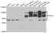 SP100 Nuclear Antigen antibody, LS-C334338, Lifespan Biosciences, Western Blot image 