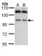 Glucosidase Alpha, Acid antibody, PA5-29051, Invitrogen Antibodies, Western Blot image 