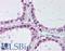 Ubiquitin Conjugating Enzyme E2 V1 antibody, LS-B2092, Lifespan Biosciences, Immunohistochemistry paraffin image 