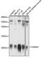 S100 Calcium Binding Protein A6 antibody, GTX64584, GeneTex, Western Blot image 