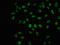Ribosomal Protein S6 Kinase B1 antibody, CSB-RA020470A421phHU, Cusabio, Immunofluorescence image 
