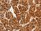 Gap Junction Protein Alpha 8 antibody, MBS2524678, MyBioSource, Immunohistochemistry paraffin image 