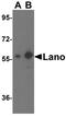 Leucine Rich Repeat Containing 1 antibody, NBP1-76678, Novus Biologicals, Western Blot image 