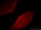 Myoferlin antibody, 19548-1-AP, Proteintech Group, Immunofluorescence image 