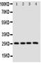 Lactalbumin Alpha antibody, PA1708, Boster Biological Technology, Western Blot image 