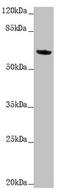 Keratin 6A antibody, LS-C675970, Lifespan Biosciences, Western Blot image 