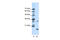 MYC Associated Factor X antibody, 28-802, ProSci, Enzyme Linked Immunosorbent Assay image 
