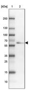 Tubulin Tyrosine Ligase Like 11 antibody, PA5-54525, Invitrogen Antibodies, Western Blot image 